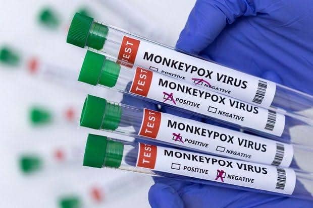 Monkeypox vaccines