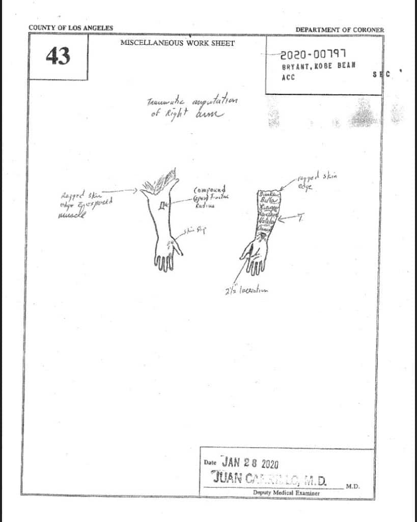 Kobe Bryant autopsy report sketch