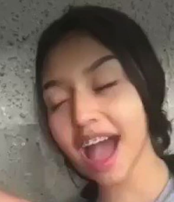 Screenshot of Viral Braces girl video